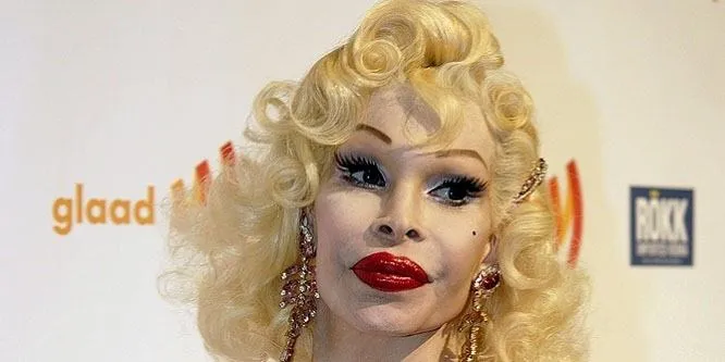 Amanda Lepore