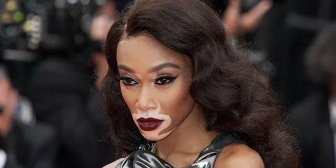 Winnie Harlow