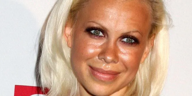 Oksana Baiul