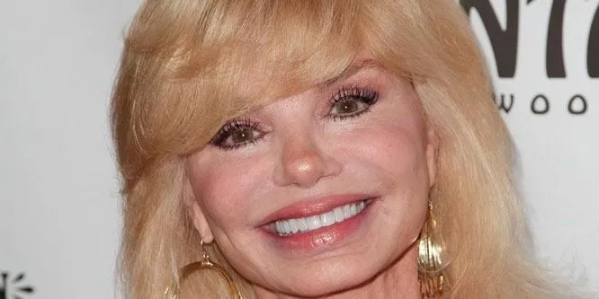 Loni Anderson